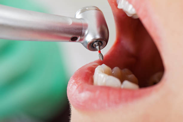 Best Urgent Care for Lost Fillings or Crowns in Churubusco, IN